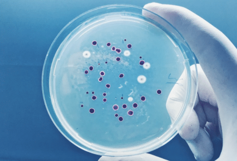 Mold and Legionella